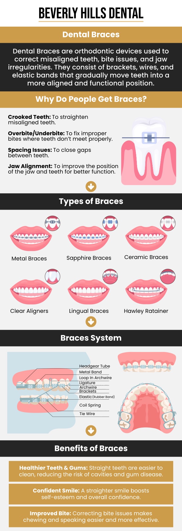 Common questions asked by patients: What are dental braces and how do they work? At what age can someone get dental braces?How long do I need to wear dental braces? What types of dental braces are available? Are dental braces painful? For more information, contact us today or book an appointment. We are conveniently located at 414 North Camden Drive #925, Beverly Hills, CA 90210.