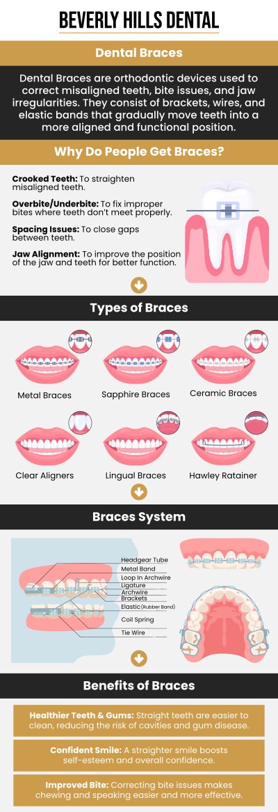 Common questions asked by patients: What are dental braces and how do they work? At what age can someone get dental braces?How long do I need to wear dental braces? What types of dental braces are available? Are dental braces painful? For more information, contact us today or book an appointment. We are conveniently located at 414 North Camden Drive #925, Beverly Hills, CA 90210.