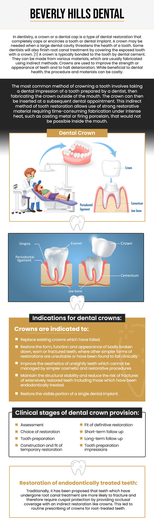 Common questions asked by patients: What is a dental crown and when is it needed? How long does a dental crown last? Are dental crowns painful to get? How much does a dental crown cost in Beverly Hills, CA? For more information, contact us today or book an appointment. We are conveniently located at 414 North Camden Drive #925, Beverly Hills, CA 90210.
