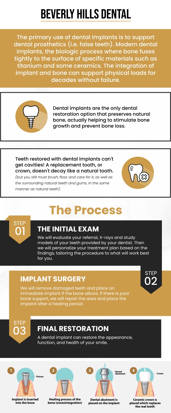 Dr. Nader Afshari, a dental implant specialist at Beverly Hills Dental, offers advanced solutions for tooth restoration in Beverly Hills, CA. Dental implants are the ideal permanent solution for missing teeth, providing both improved functionality and a natural appearance. At Beverly Hills Dental, we prioritize personalized care, tailoring each treatment to meet the unique needs of our patients. For more information, contact us today or book an appointment. We are conveniently located at 414 North Camden Drive #925, Beverly Hills, CA 90210. 