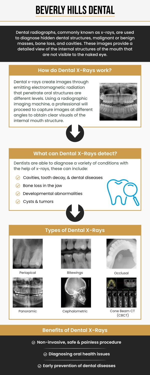 Common questions asked by patients: What are dental X-rays and why are they needed? Are dental X-rays safe? How often should I get dental X-rays? What problems can dental X-rays detect? For more information, contact us today or book an appointment. We are conveniently located at 414 North Camden Drive #925, Beverly Hills, CA 90210.