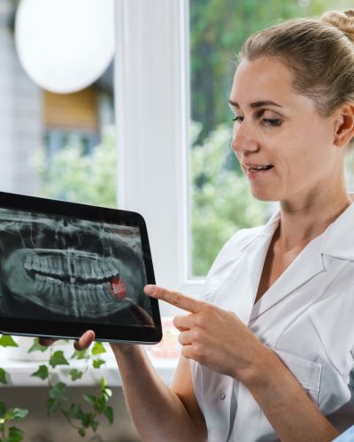 Wisdom Teeth Near Me in Beverly Hills, CA