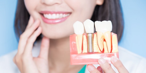 Zirconia Implants vs. Titanium Implants | Beverly Hills, CA Zirconia Implants vs. Titanium Implants | Beverly Hills, CA